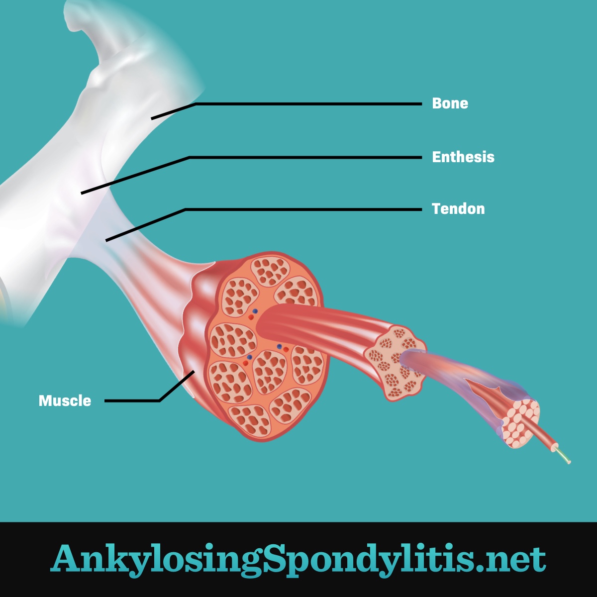 Where the tendon connects to the bone