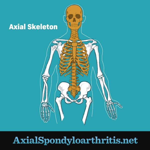 How Does Axial SpondyloArthritIs Progress?