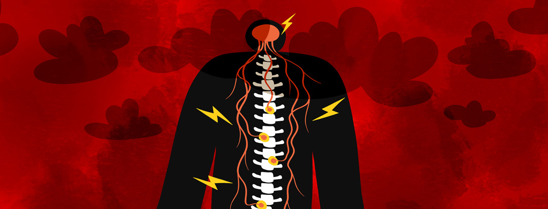 A figure showing a spine connecting to the brain with pain signals, and clouds of brain fog in the background.