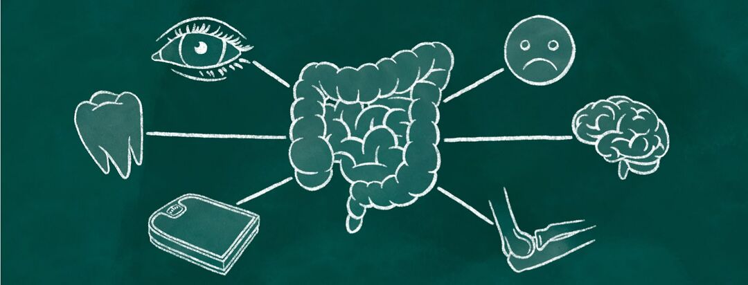 Chalkboard showing some of the various symptoms stemming from gut inflammation